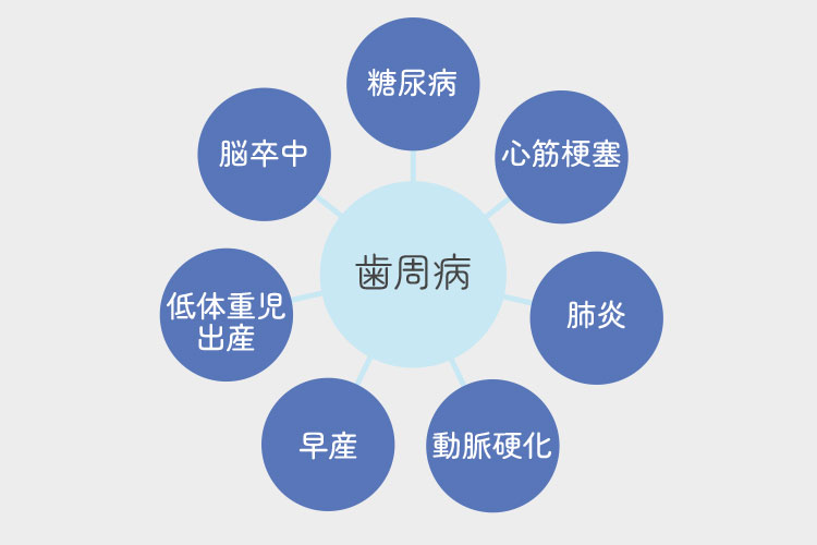 歯周病のイメージ写真